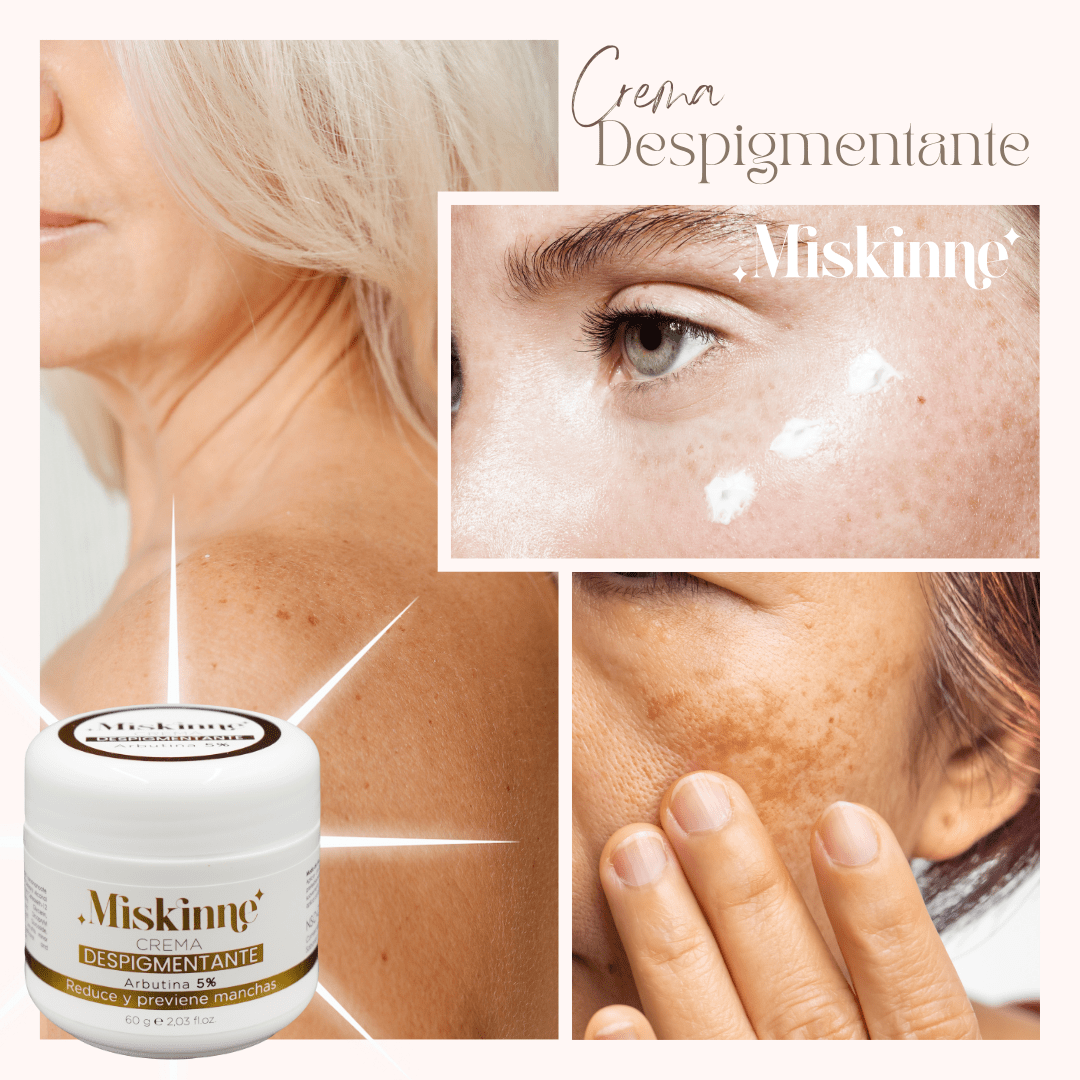 Crema Despigmentante Miskinne - Luce Bella